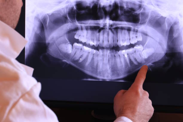 Best Urgent Care for Lost Fillings or Crowns in York, NE