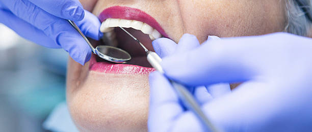 Best Urgent Care for Lost Fillings or Crowns in York, NE